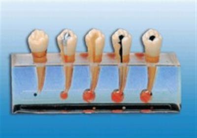 牙髓病临床模型HK-L1011