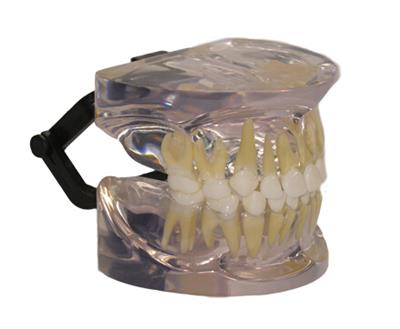 透明成人牙模型HK-L1007