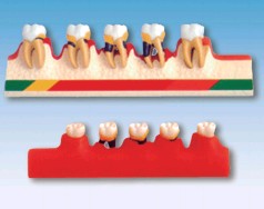 牙周病分类模型HK-L1010