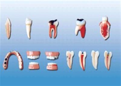 牙齿病变系列模型HK-L1012