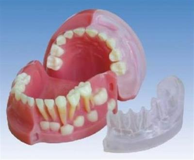 三岁乳恒牙交替解剖模型HK-L1021