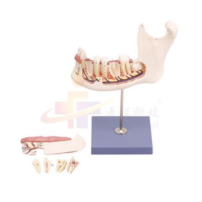 舌根、下颌骨模型