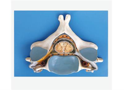 第五颈椎附脊髓和脊神经放大模型XY-A18104