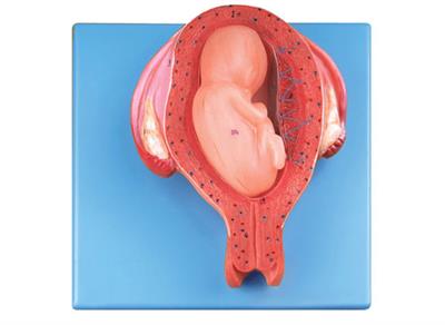 五个月胎儿模型XY-A42005-5