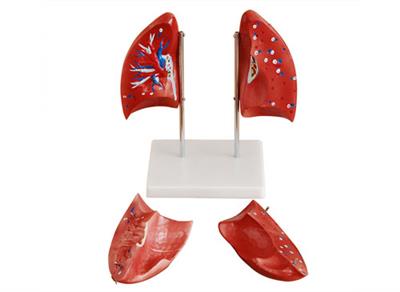肺解剖模型XY-321