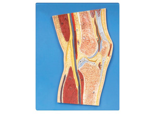 膝关节剖面模型XY-A11206