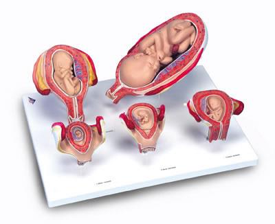妊娠系列模型-德国3B-L11-9