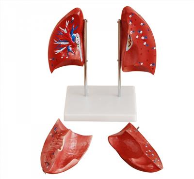 肺解剖模型KAY-321