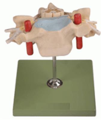 颈椎附脊髓和脊神经放大模型KL1208