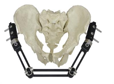 骨盆骨折A型