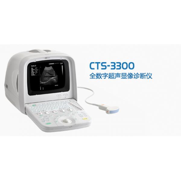 B超全数字化（便携式）CTS-3300