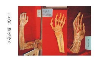 手关节标本骨的构造