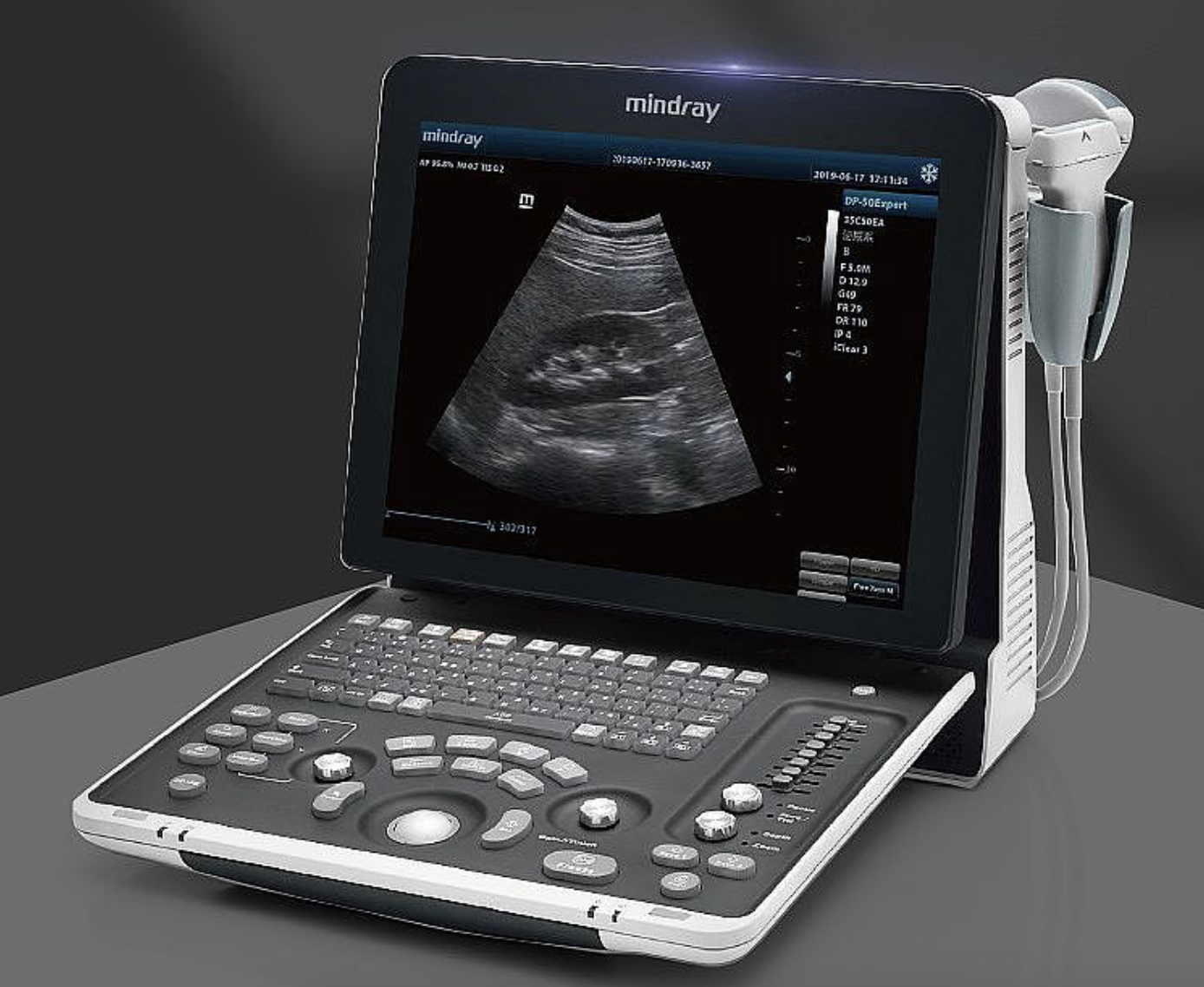 迈瑞Mindray 全数字便携式超声诊断系统 DP-50