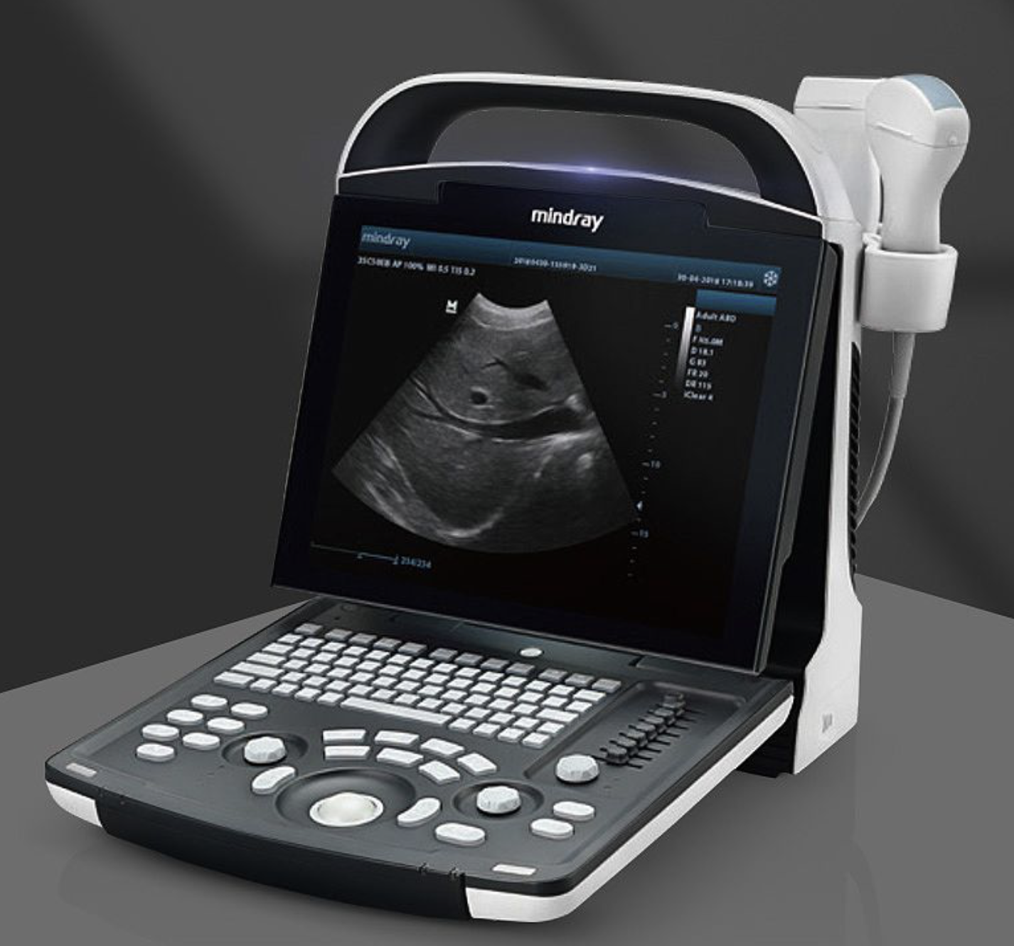 迈瑞Mindray 全数字便携式超声诊断系统 DP-20标配（主机+腹部35C50EB）