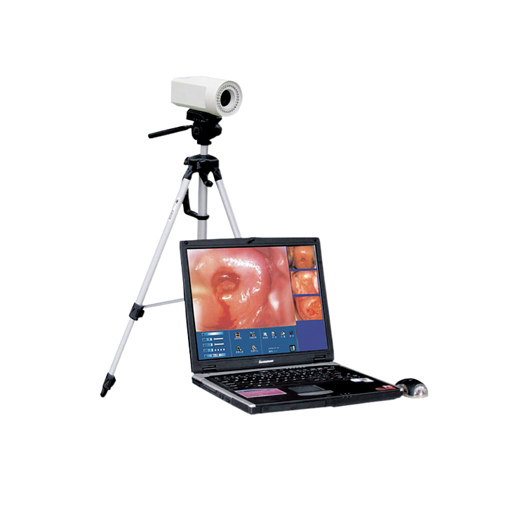 信达XINDA 电子阴道镜工作站 XD-6000Y (便携式)