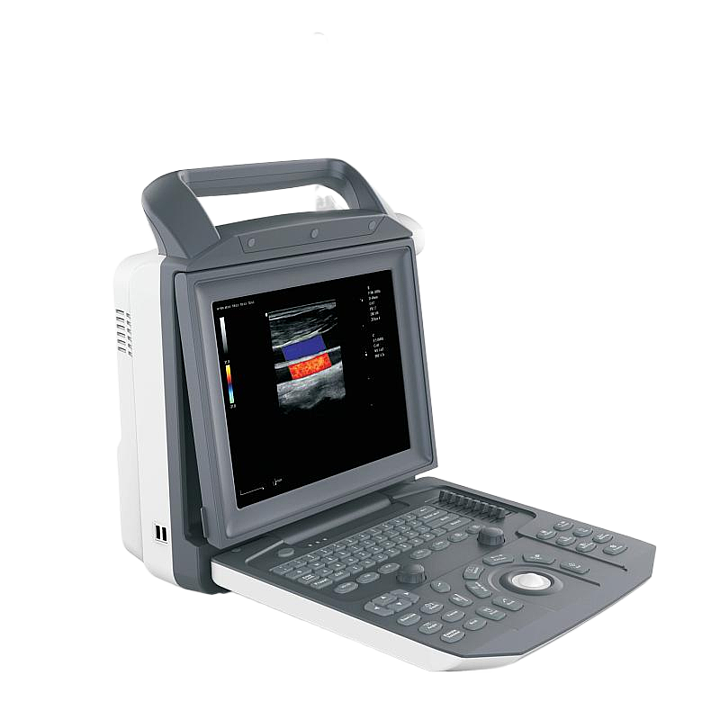 中旗 Zoncare 彩色多普勒超声系统 ZONCARE-V5（主机+腹部探头）