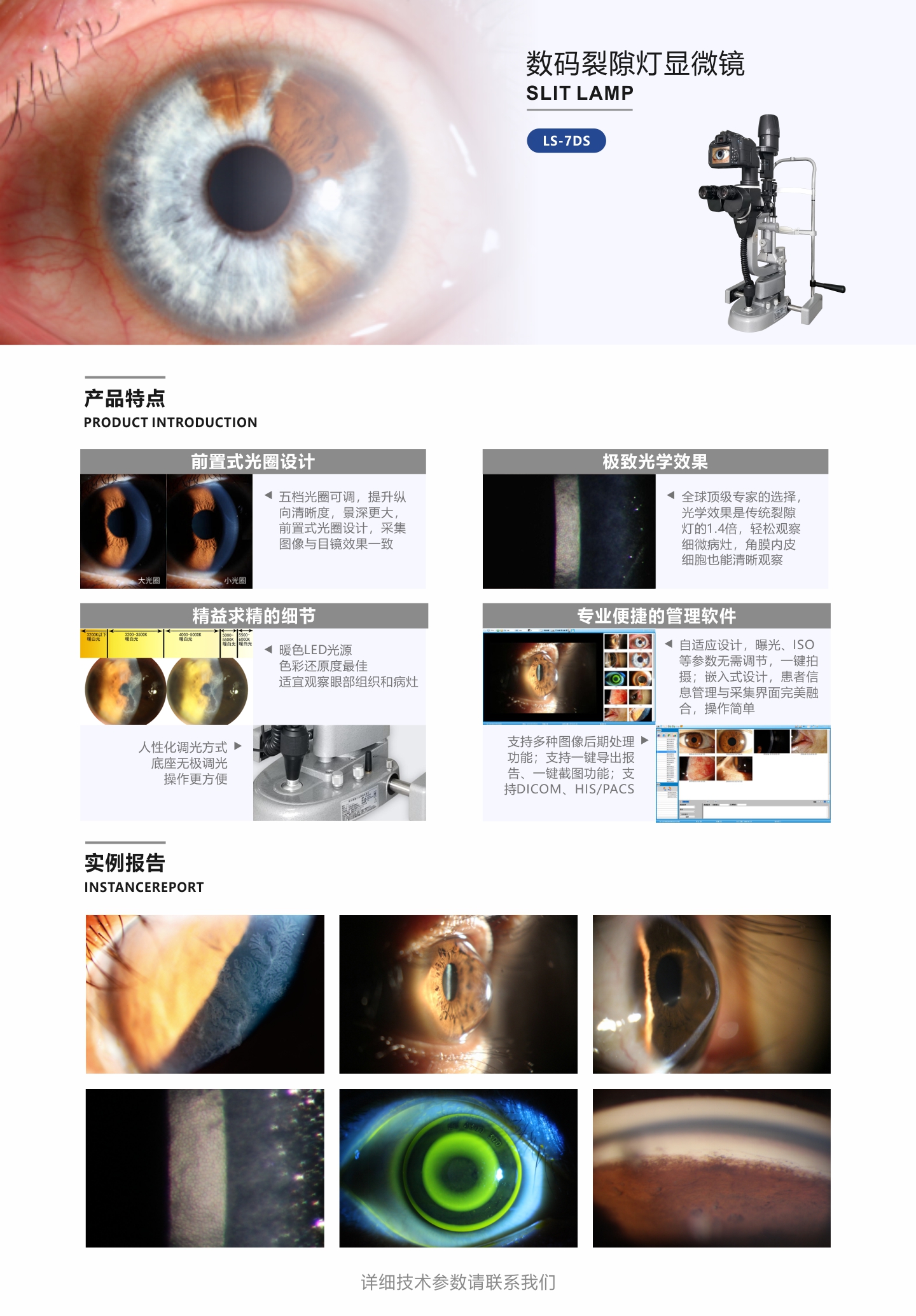 LS-7DS 数码裂隙灯