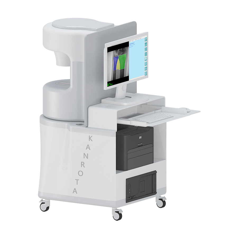 DEXA-iMAX 数字化双能X射线骨密度