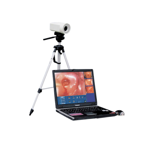 信达XINDA 电子阴道镜工作站 XD-6000Y (便携式)