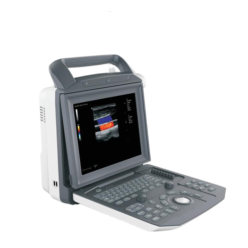 中旗Zoncare 全数字彩色多普勒超声诊断系统 ZONCARE-V5