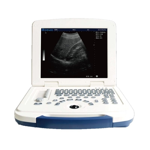 大为 笔记本全数字超声诊断仪 DW-580