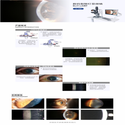 LS-7DE 数码裂隙灯